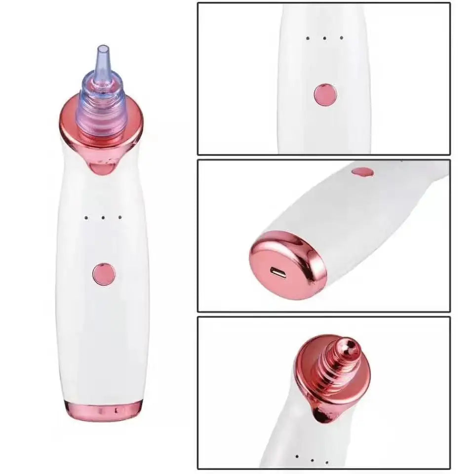 Blackhead Remover Pore Vacuum | Electric Pore Cleaner | 5 Suction Levels
