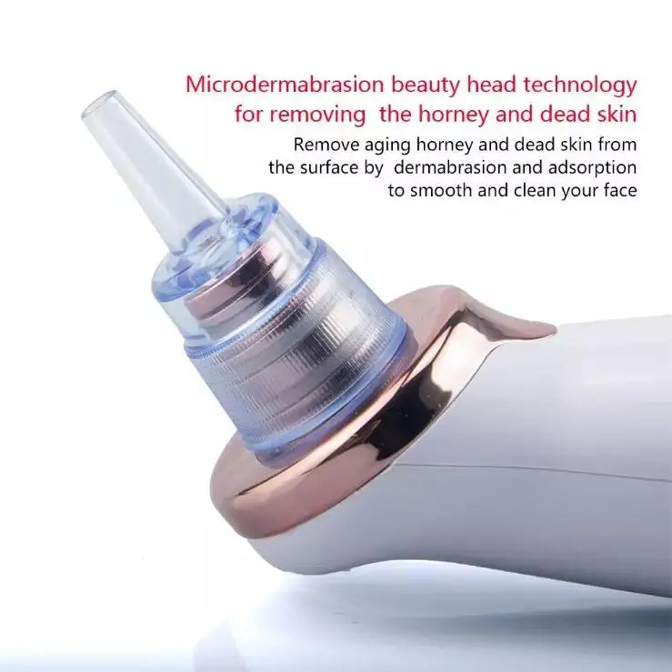 Blackhead Remover Pore Vacuum | Electric Pore Cleaner | 5 Suction Levels