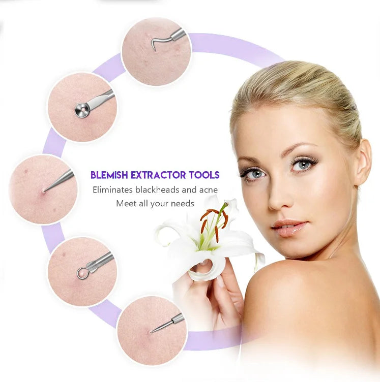 Blackhead Remover Pore Vacuum | Electric Pore Cleaner | 5 Suction Levels