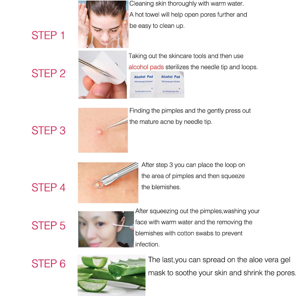 Blackhead Remover Pore Vacuum | Electric Pore Cleaner | 5 Suction Levels