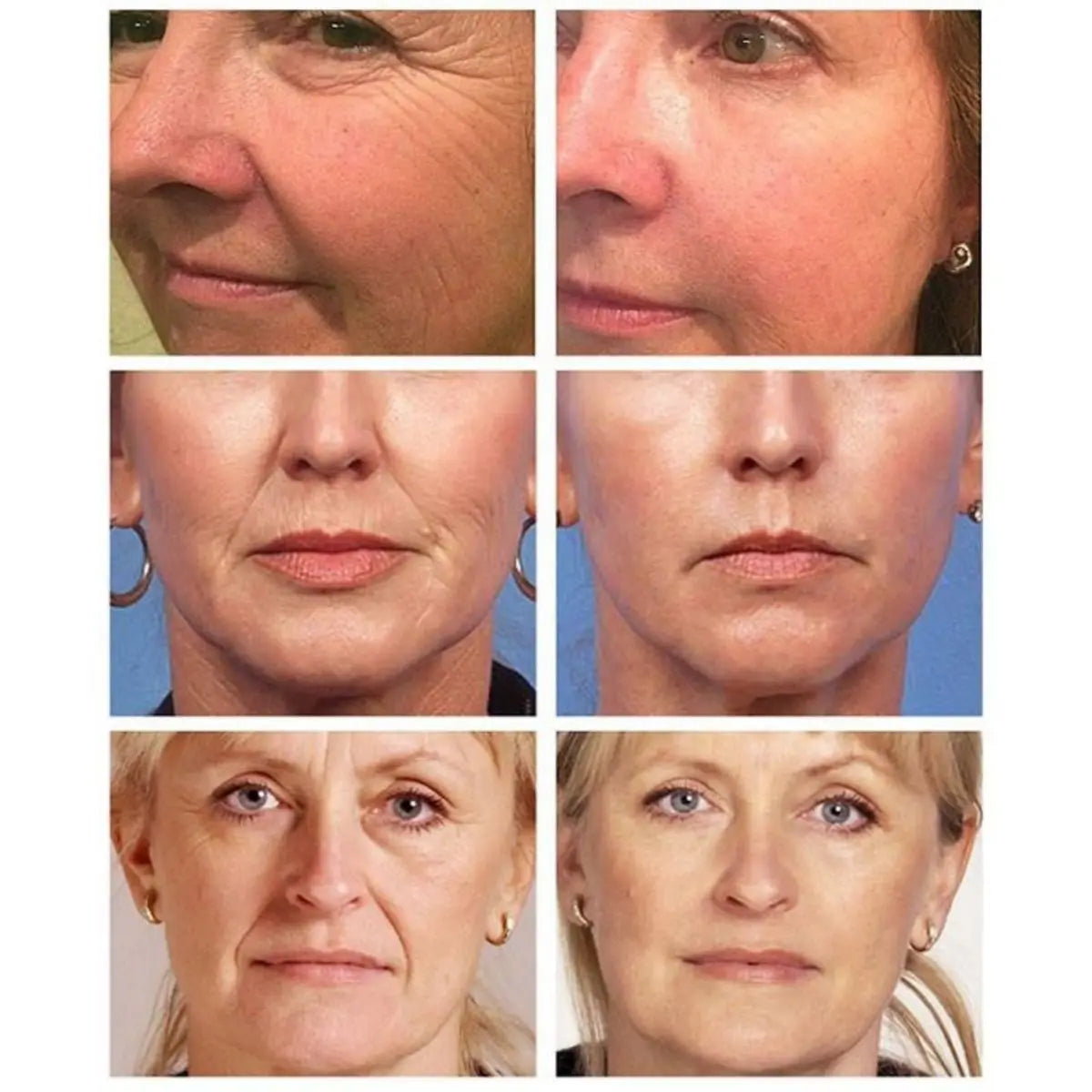 Retinol Face Cream | Anti-Aging, Firming & Brightening | All Skin Types