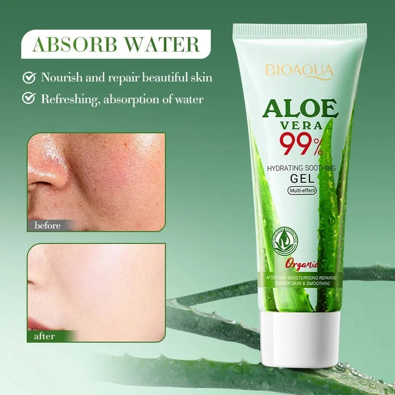 Aloe Vera Gel | Soothing & Hydrating | Face, Body & Sunburn Relief