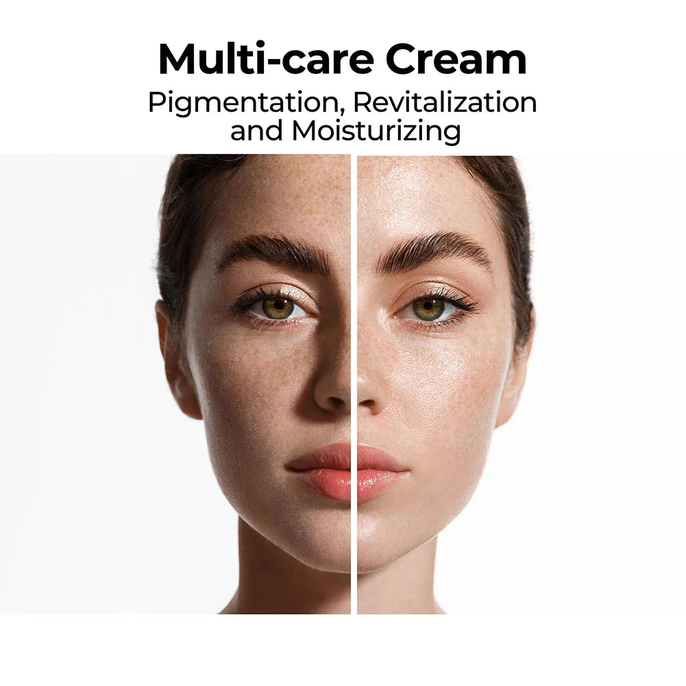 Skin Brightening Cream — Dark Spot Remover